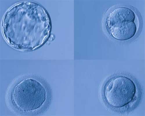 长沙代怀哪家最好,输卵管性不孕可以做试管吗-供卵代生医院_试管婴儿移植后可